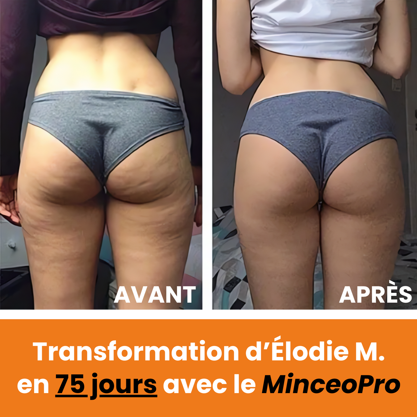 MinceoPro Sculpt & Minceur (🎁 +3 pads /e-book offerts)