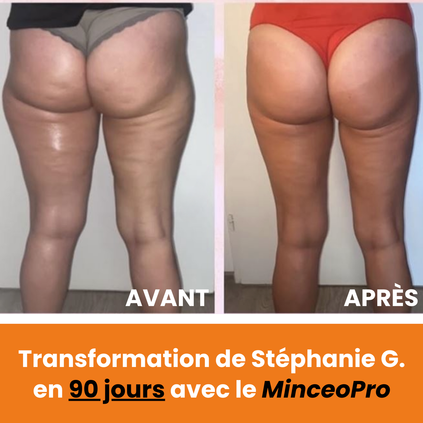 MinceoPro Sculpt & Minceur (🎁 +3 pads /e-book offerts)