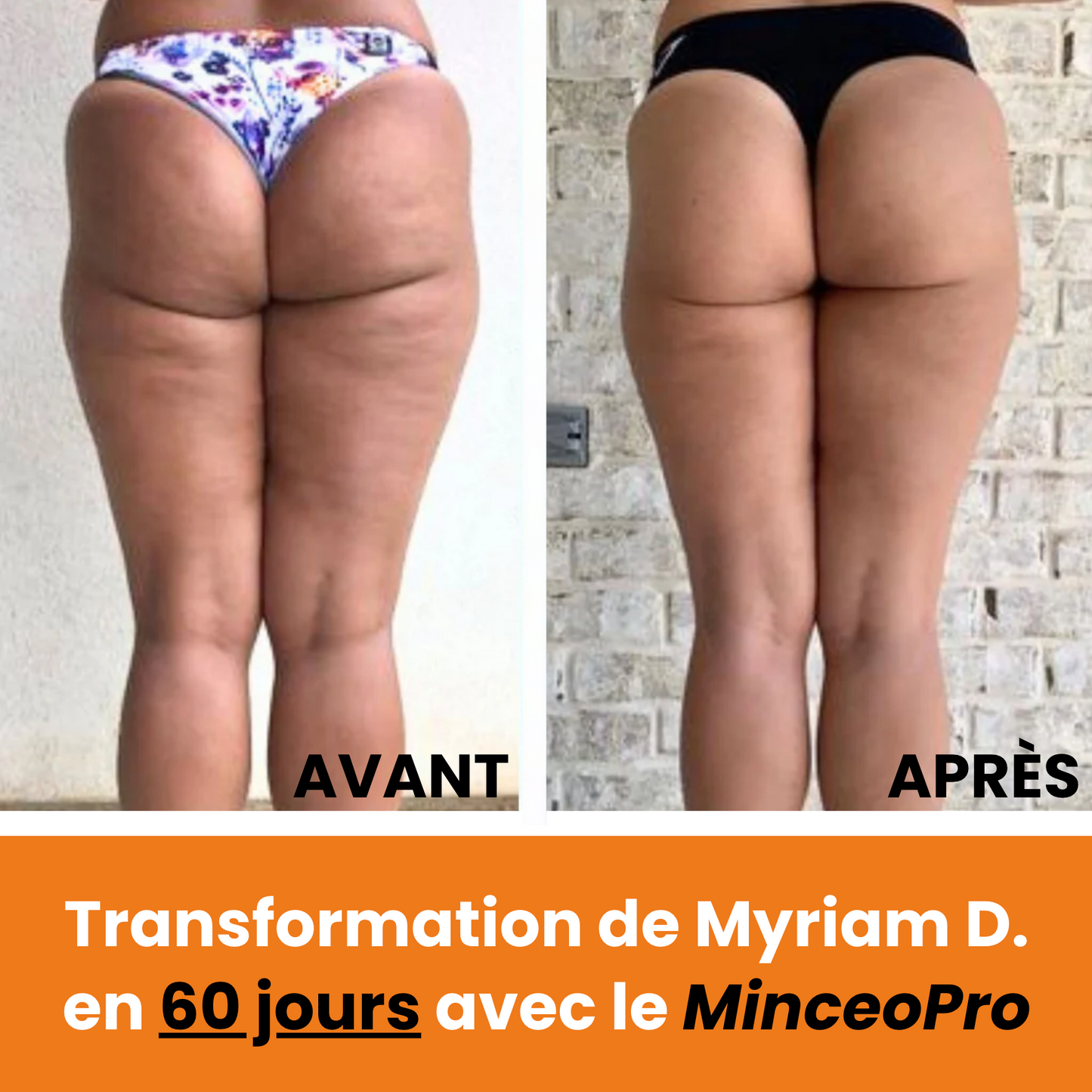 MinceoPro Sculpt & Minceur (🎁 +3 pads /e-book offerts)